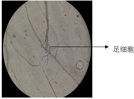 黴菌的形態觀察