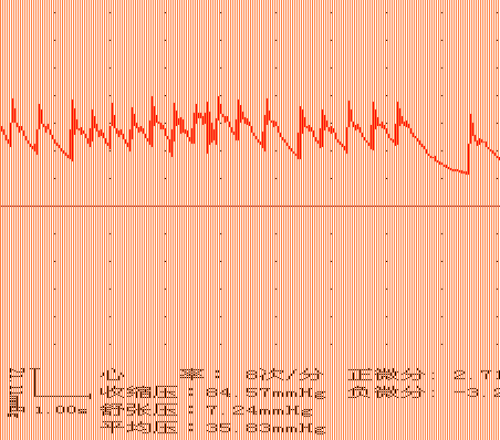 家兔动脉血压图图片