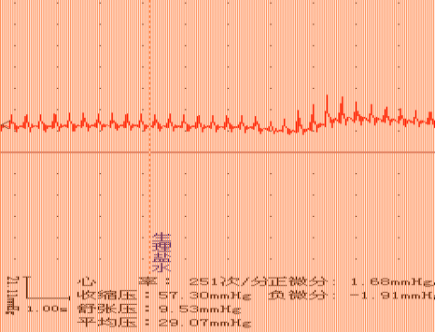 家兔动脉血压实验图图片