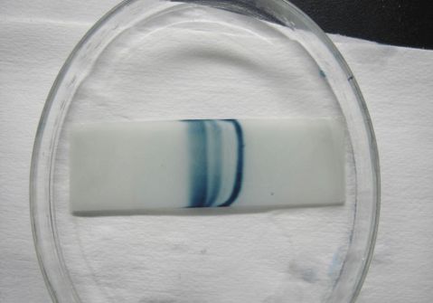 实验五醋酸纤维薄膜电泳法分离牛血清蛋白