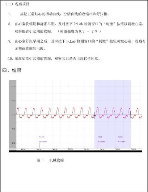 辨认心电图各波段:p波,qrs波群,t波,p